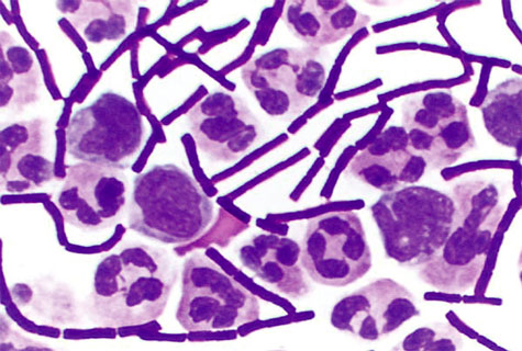 Than - Hình ảnh minh họa